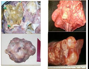 Liver and lung affected by E. granulosus infection – Gevorgyan, 2011, Armenia
